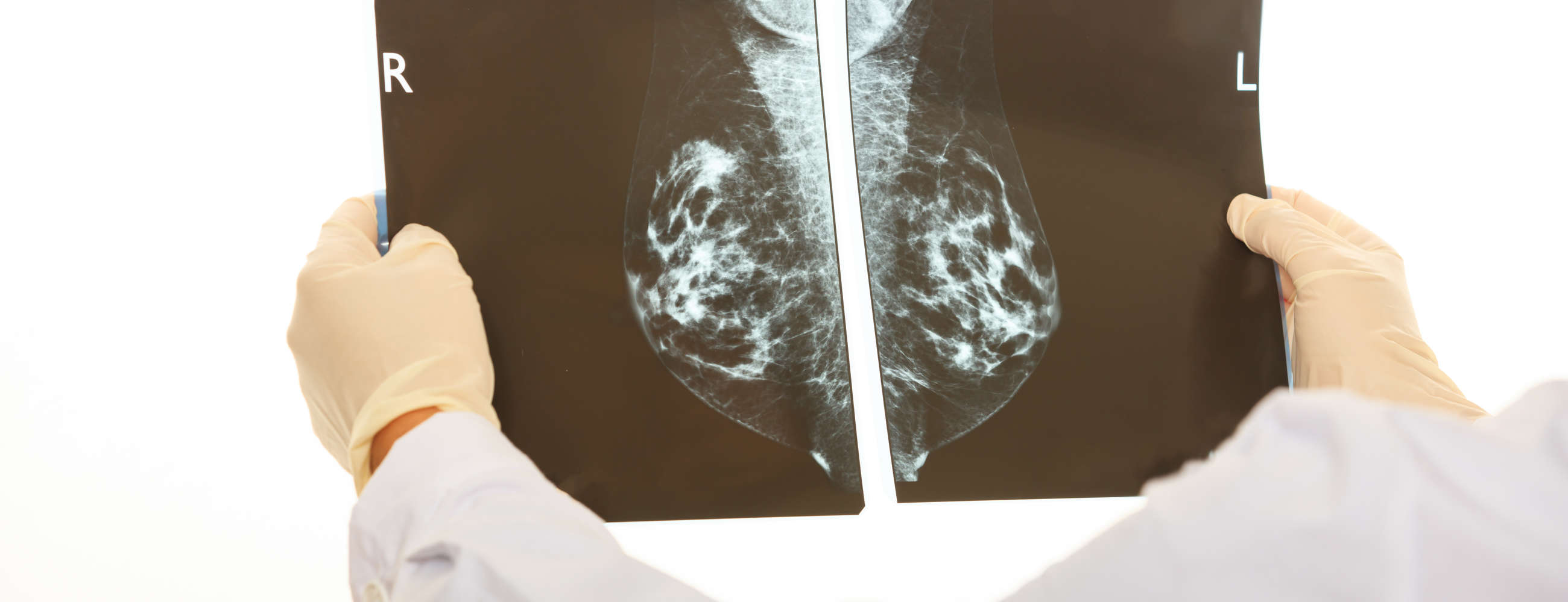 Thema - Vorsorge gegen Brustkrebs - der Vinschger